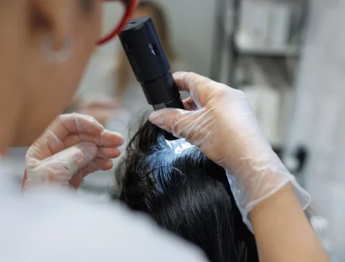 hair scalp 1