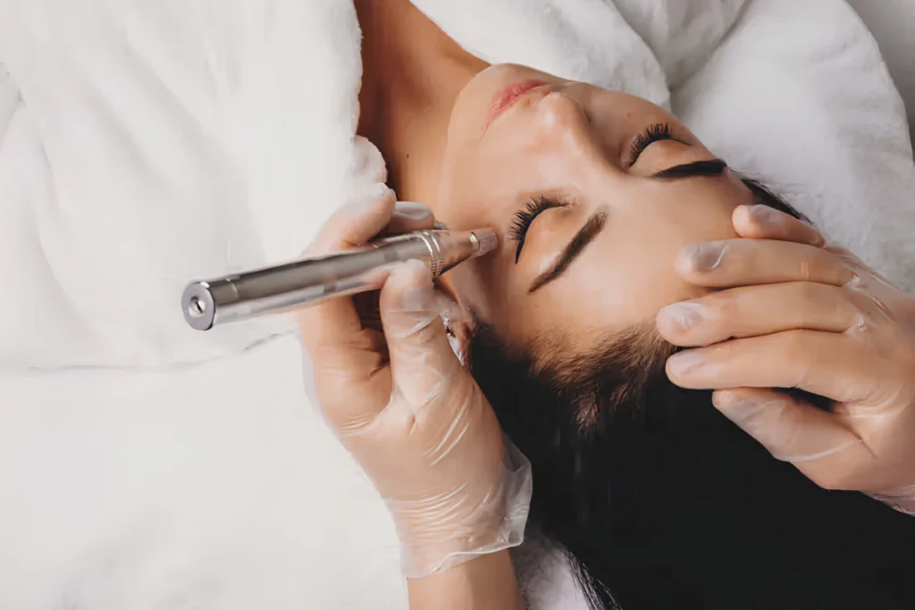 A gloved dermatologist performing a microneedling skin care procedure on a patient's cheek area for skin rejuvenation.