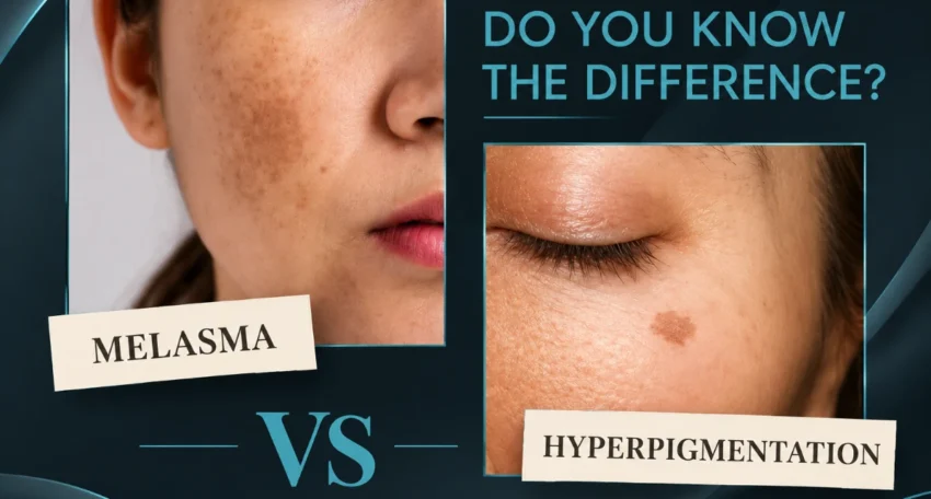 Comparison graphic showing dark patches of melasma on the cheek versus a targeted spot of hyperpigmentation below the eye with text asking "Do You Know The Difference?"